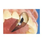 نوار ماتریس قدامی و دو طرفه 12 عددی 1.523 | 1.533 TorVM - تصویر 2