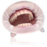 دهان باز کن اپتراگیت ایووکلار